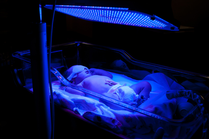 NICU team monitoring newborn during phototherapy